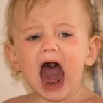 Una afección común a los bebés