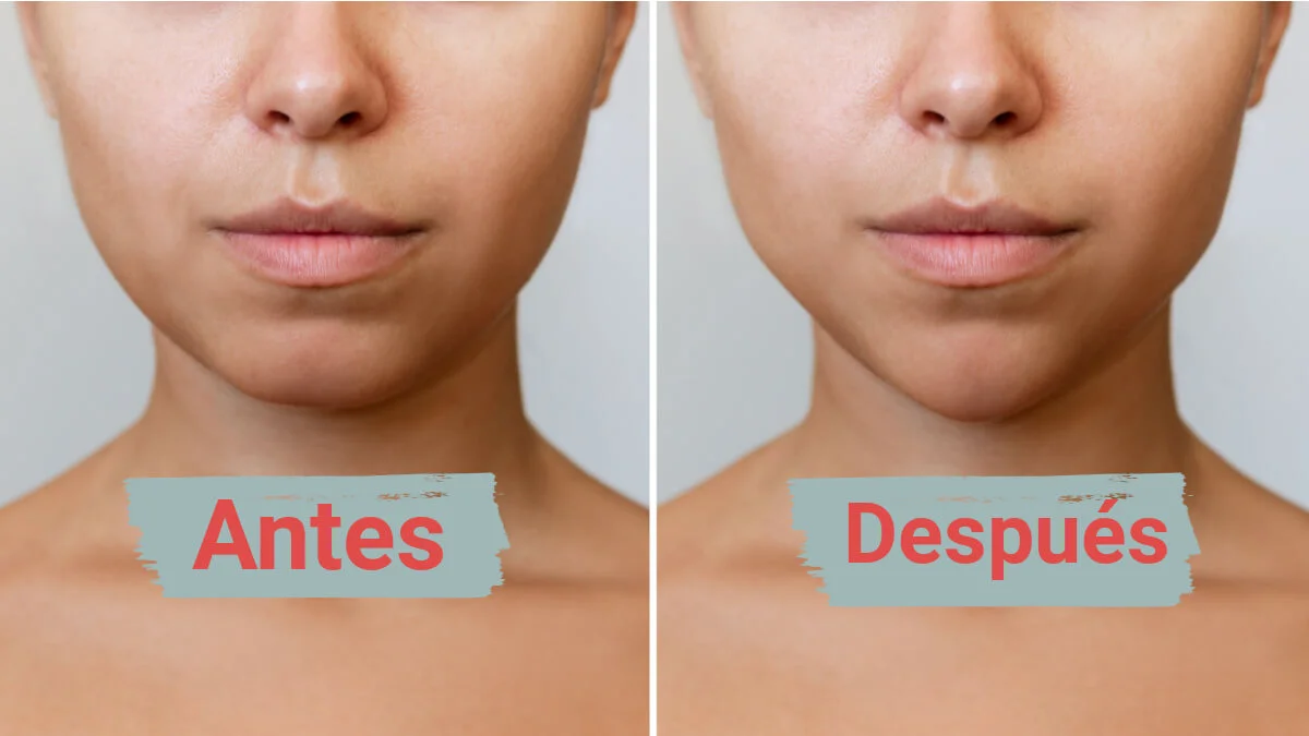 Persona mostrando el perfil del rostro en una imagen informativa sobre mewing y postura lingual.